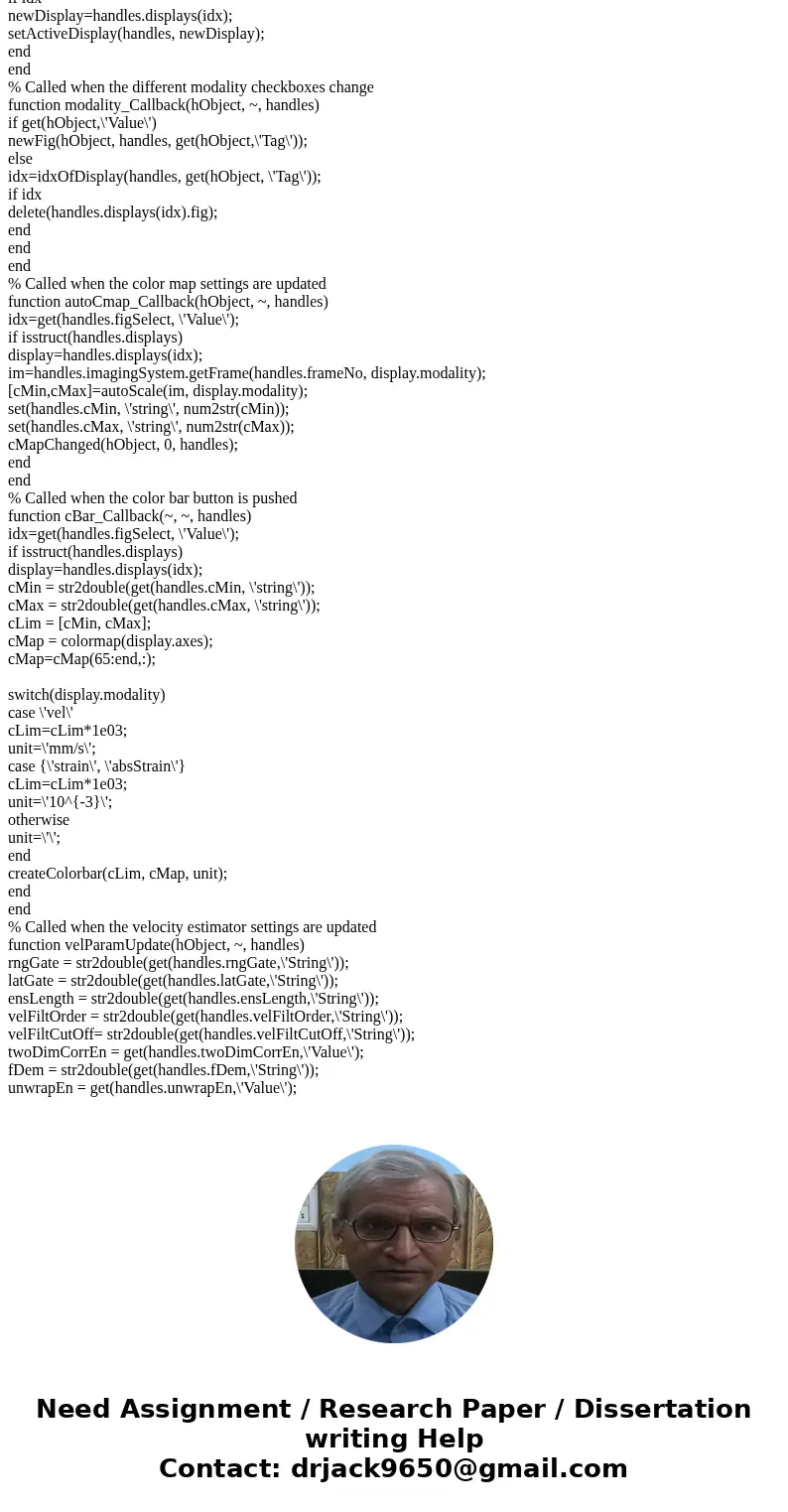 write a MATLAB GUI program that implements an ultrasound image viewing and manipulation program. Your program must have the following features: (a) Load and dis write a MATLAB GUI program that implements an ultrasound image viewing and manipulation program. Your program must have the following features: (a) Load and dis
