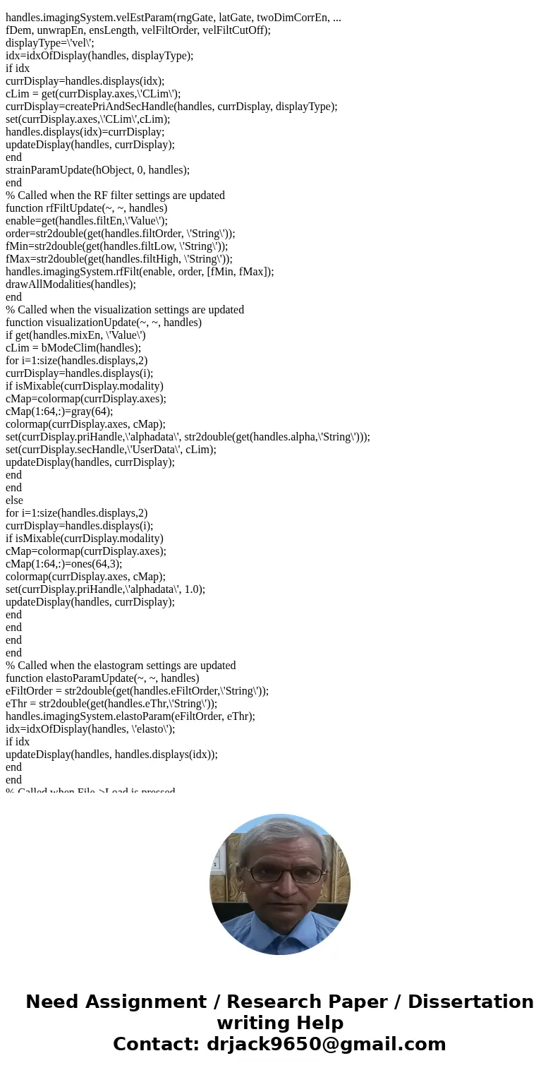 write a MATLAB GUI program that implements an ultrasound image viewing and manipulation program. Your program must have the following features: (a) Load and dis write a MATLAB GUI program that implements an ultrasound image viewing and manipulation program. Your program must have the following features: (a) Load and dis