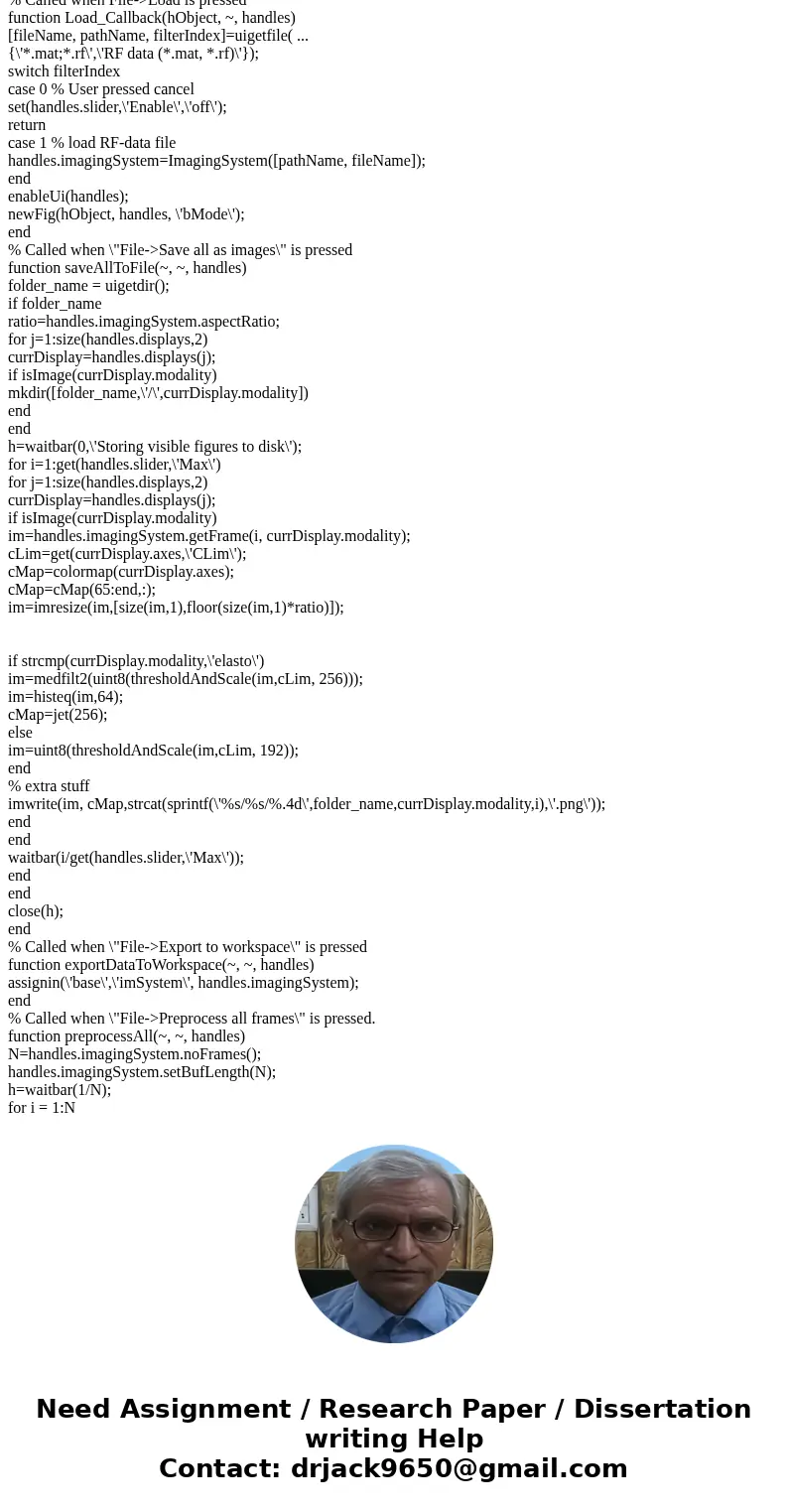 write a MATLAB GUI program that implements an ultrasound image viewing and manipulation program. Your program must have the following features: (a) Load and dis write a MATLAB GUI program that implements an ultrasound image viewing and manipulation program. Your program must have the following features: (a) Load and dis