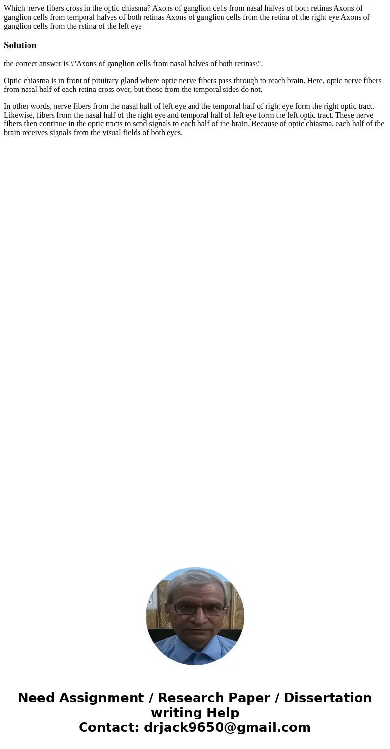 Which nerve fibers cross in the optic chiasma? Axons of ganglion cells from nasal halves of both retinas Axons of ganglion cells from temporal halves of both r  Which nerve fibers cross in the optic chiasma? Axons of ganglion cells from nasal halves of both retinas Axons of ganglion cells from temporal halves of both r