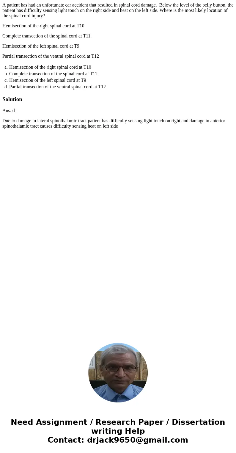 A patient has had an unfortunate car accident that resulted in spinal cord damage. Below the level of the belly button, the patient has difficulty sensing light