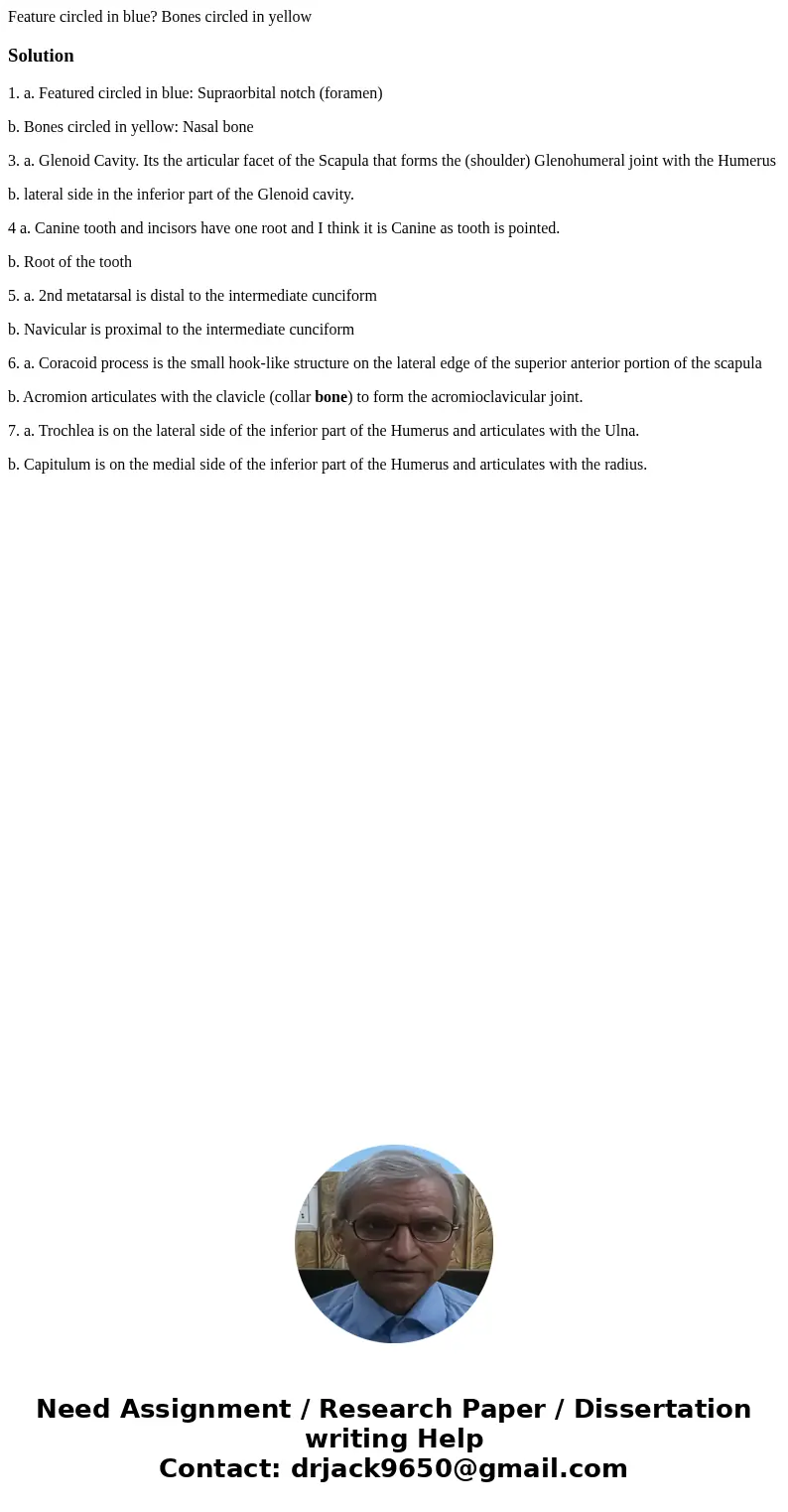 Feature circled in blue? Bones circled in yellow Solution1. a. Featured circled in blue: Supraorbital notch (foramen) b. Bones circled in yellow: Nasal bone 3.  Feature circled in blue? Bones circled in yellow Solution1. a. Featured circled in blue: Supraorbital notch (foramen) b. Bones circled in yellow: Nasal bone 3.