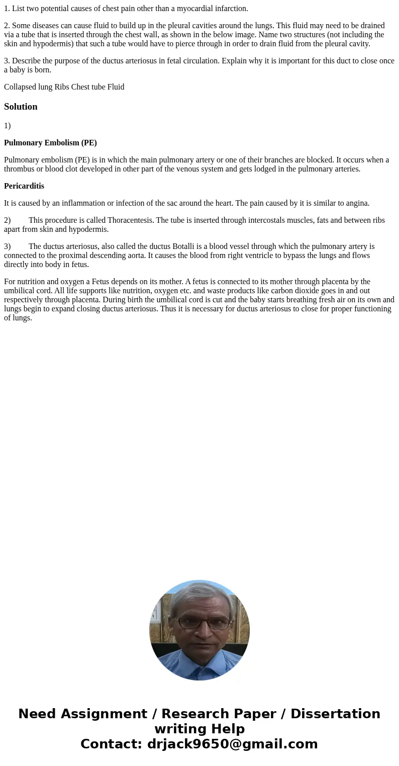 1. List two potential causes of chest pain other than a myocardial infarction. 2. Some diseases can cause fluid to build up in the pleural cavities around the l 1. List two potential causes of chest pain other than a myocardial infarction. 2. Some diseases can cause fluid to build up in the pleural cavities around the l