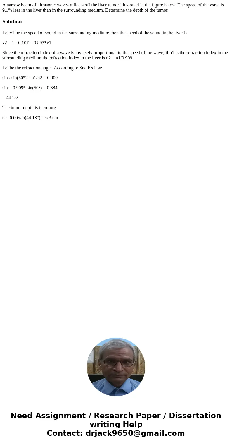 A narrow beam of ultrasonic waves reflects off the liver tumor illustrated in the figure below. The speed of the wave is 9.1% less in the liver than in the sur  A narrow beam of ultrasonic waves reflects off the liver tumor illustrated in the figure below. The speed of the wave is 9.1% less in the liver than in the sur