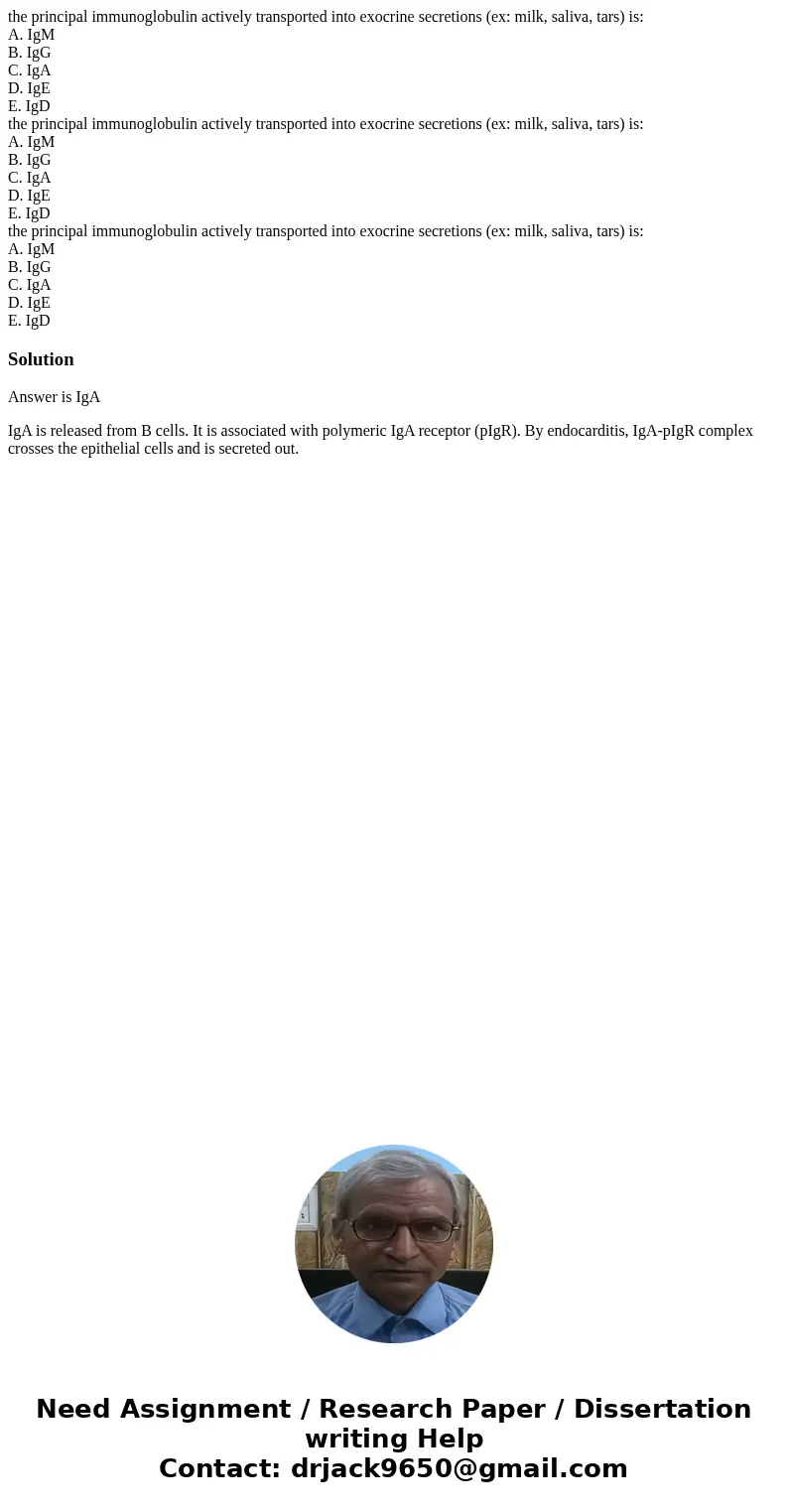 the principal immunoglobulin actively transported into exocrine secretions (ex: milk, saliva, tars) is: A. IgM B. IgG C. IgA D. IgE E. IgD the principal immuno  the principal immunoglobulin actively transported into exocrine secretions (ex: milk, saliva, tars) is: A. IgM B. IgG C. IgA D. IgE E. IgD the principal immuno