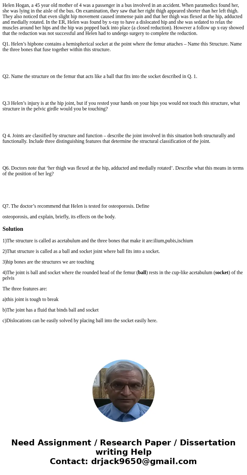 Helen Hogan, a 45 year old mother of 4 was a passenger in a bus involved in an accident. When paramedics found her, she was lying in the aisle of the bus. On ex