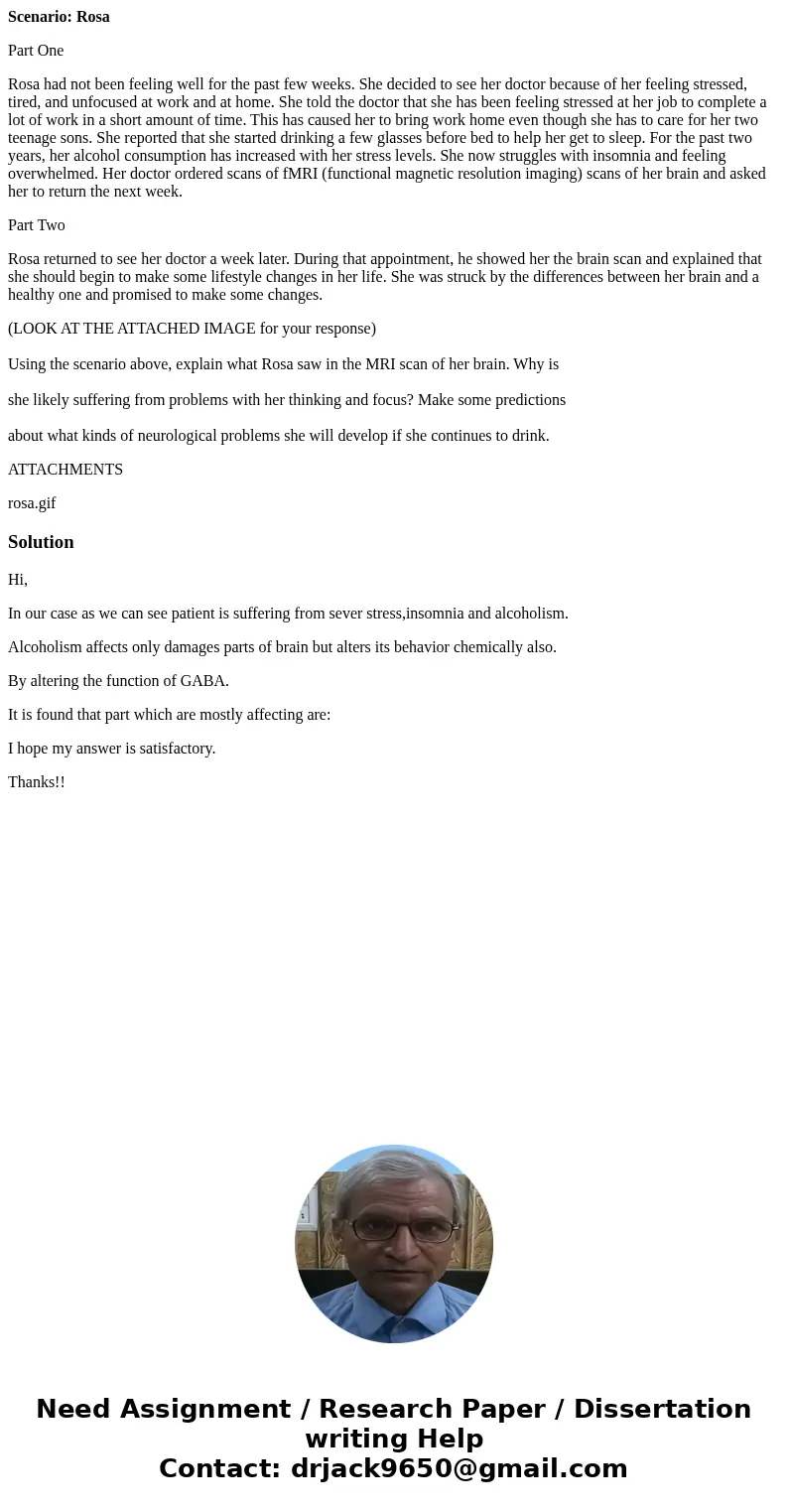 Scenario: Rosa Part One Rosa had not been feeling well for the past few weeks. She decided to see her doctor because of her feeling stressed, tired, and unfocus Scenario: Rosa Part One Rosa had not been feeling well for the past few weeks. She decided to see her doctor because of her feeling stressed, tired, and unfocus