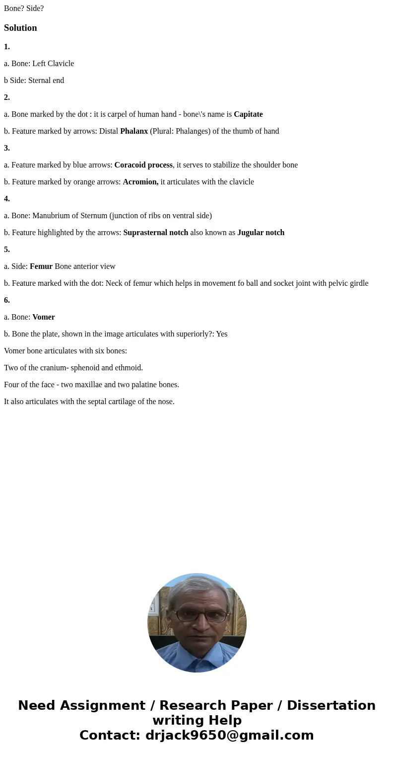 Bone? Side? Solution1. a. Bone: Left Clavicle b Side: Sternal end 2. a. Bone marked by the dot : it is carpel of human hand - bone\'s name is Capitate b. Featu  Bone? Side? Solution1. a. Bone: Left Clavicle b Side: Sternal end 2. a. Bone marked by the dot : it is carpel of human hand - bone\'s name is Capitate b. Featu