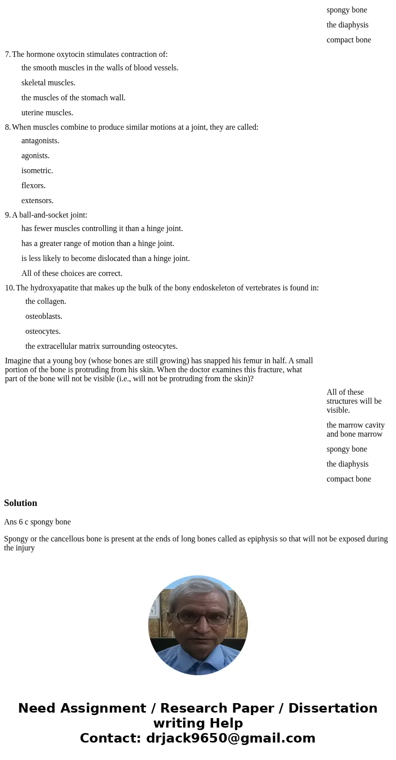  Imagine that a young boy (whose bones are still growing) has snapped his femur in half. A small portion of the bone is protruding from his skin. When the docto