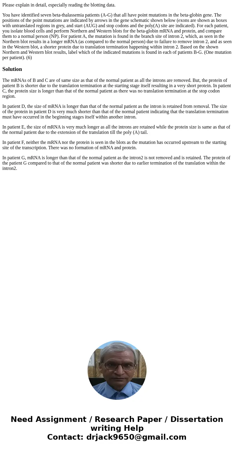 Please explain in detail, especially reading the blotting data. You have identified seven beta-thalassemia patients (A-G) that all have point mutations in the b Please explain in detail, especially reading the blotting data. You have identified seven beta-thalassemia patients (A-G) that all have point mutations in the b