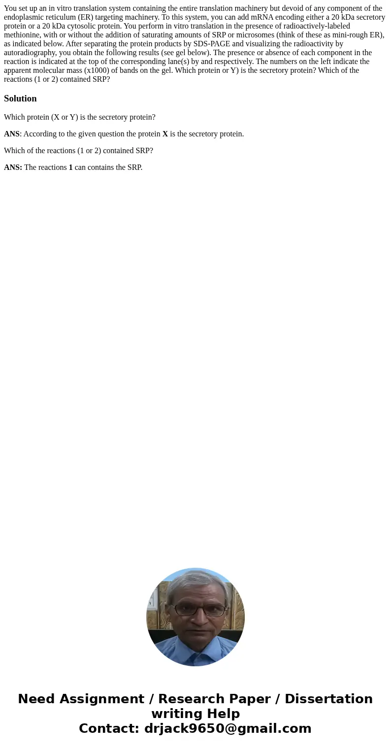 You set up an in vitro translation system containing the entire translation machinery but devoid of any component of the endoplasmic reticulum (ER) targeting m  You set up an in vitro translation system containing the entire translation machinery but devoid of any component of the endoplasmic reticulum (ER) targeting m