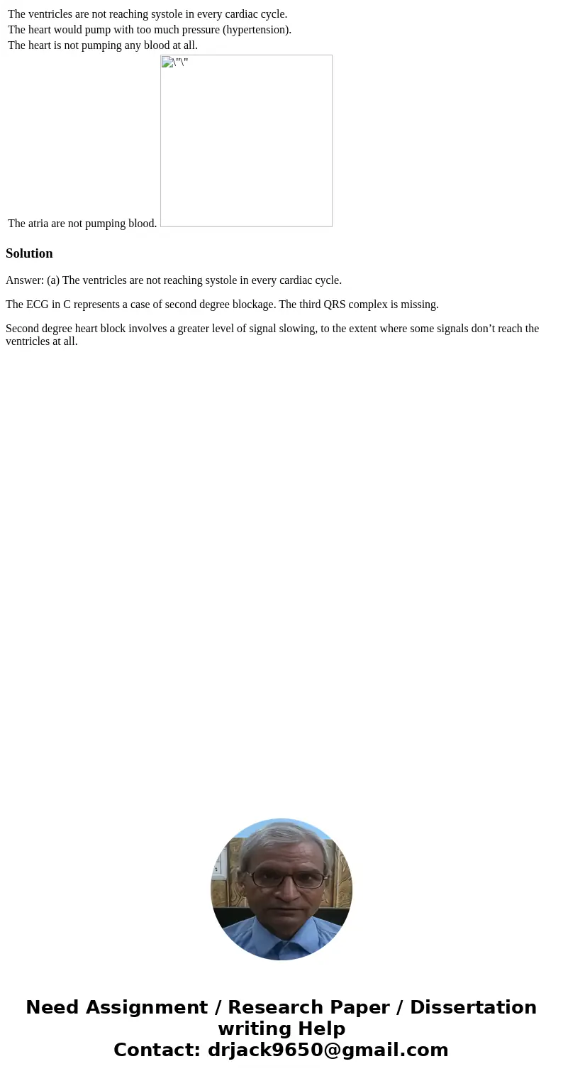  The ventricles are not reaching systole in every cardiac cycle. The heart would pump with too much pressure (hypertension). The heart is not pumping any blood 
