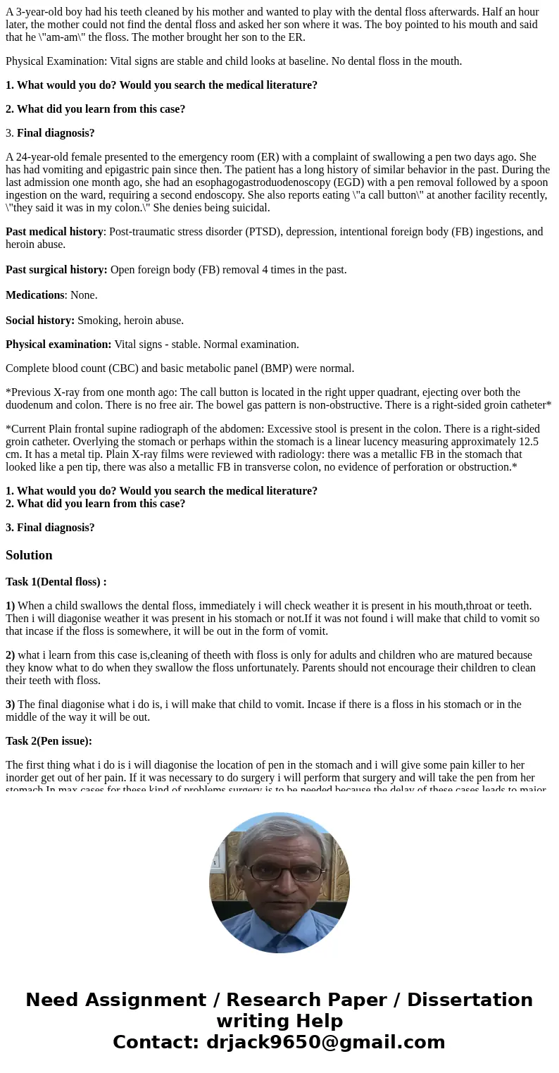 A 3-year-old boy had his teeth cleaned by his mother and wanted to play with the dental floss afterwards. Half an hour later, the mother could not find the dent A 3-year-old boy had his teeth cleaned by his mother and wanted to play with the dental floss afterwards. Half an hour later, the mother could not find the dent