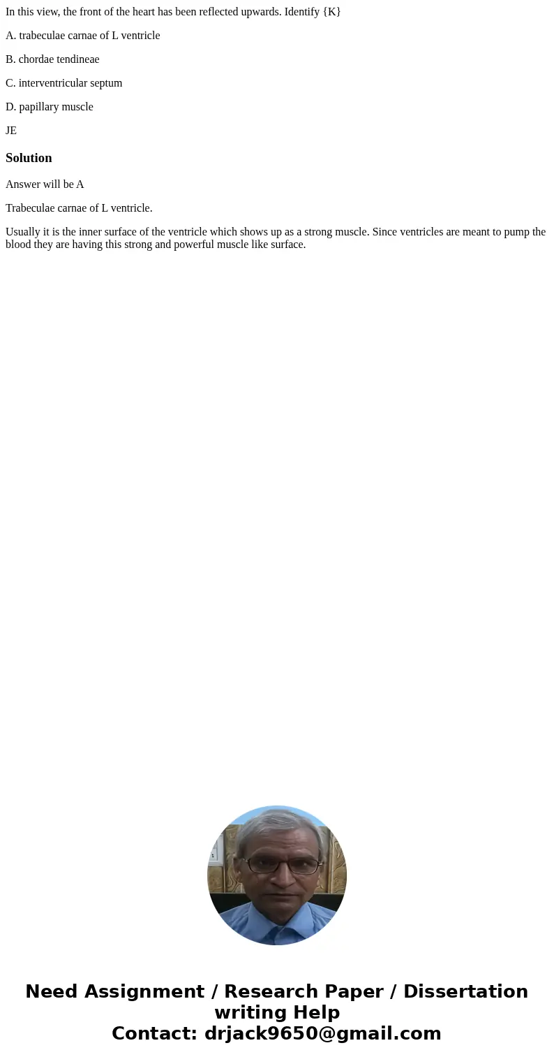 In this view, the front of the heart has been reflected upwards. Identify {K} A. trabeculae carnae of L ventricle B. chordae tendineae C. interventricular septu In this view, the front of the heart has been reflected upwards. Identify {K} A. trabeculae carnae of L ventricle B. chordae tendineae C. interventricular septu