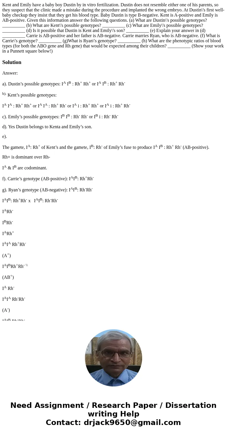 Kent and Emily have a baby boy Dustin by in vitro fertilization. Dustin does not resemble either one of his parents, so they suspect that the clinic made a mis  Kent and Emily have a baby boy Dustin by in vitro fertilization. Dustin does not resemble either one of his parents, so they suspect that the clinic made a mis