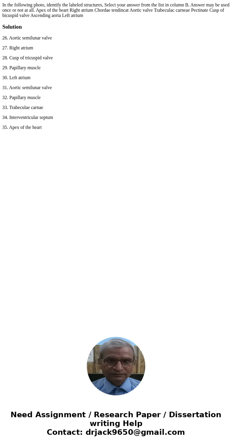 In the following photo, identify the labeled structures, Select your answer from the list in column B. Answer may be used once or not at all. Apex of the heart  In the following photo, identify the labeled structures, Select your answer from the list in column B. Answer may be used once or not at all. Apex of the heart